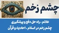 چشم زخم یا چشم نظر چیست؟ از لحاظ دینی و علمی | راه درمان و پیشگیری